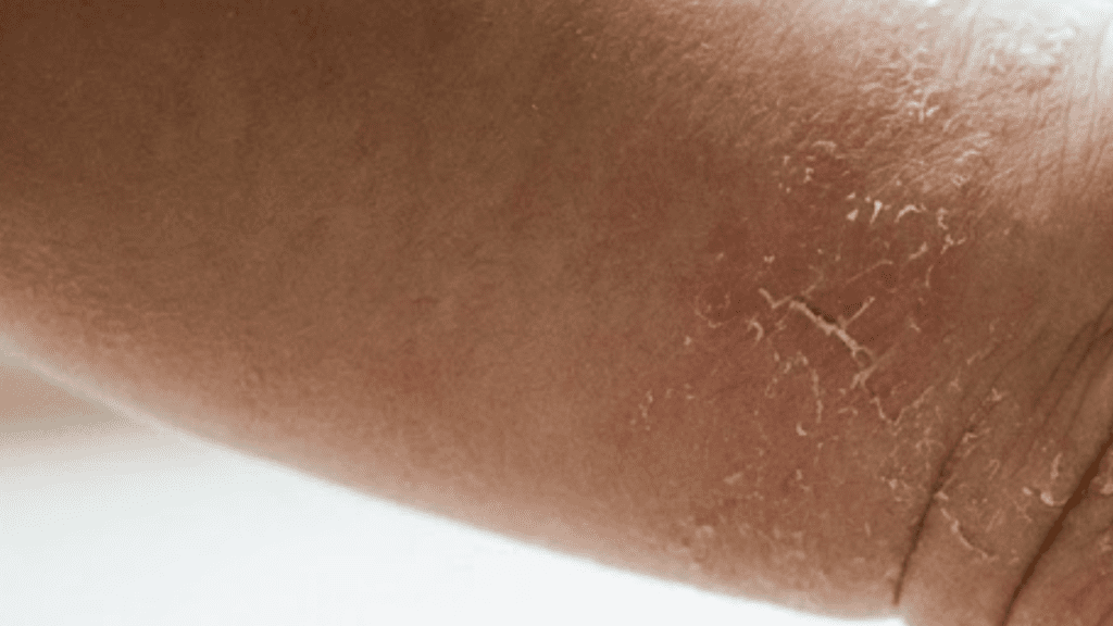 Hidratante para pele do bebê ressecada